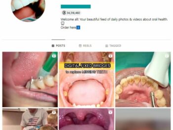 75K Dentistry Science Instagram Account for sale