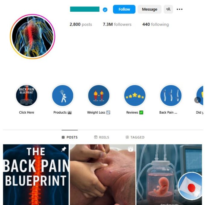 7.2M Back Pain Health Instagram Account for sale